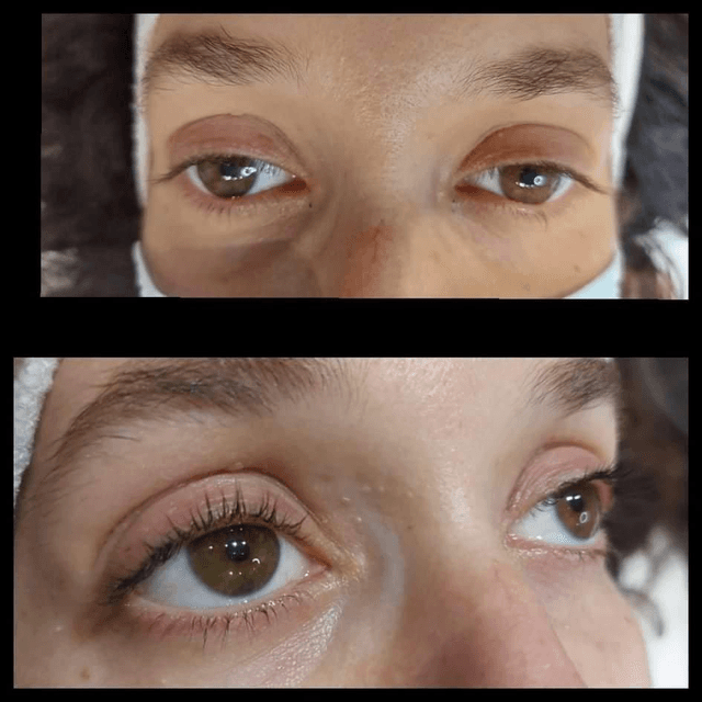 Eyelash beauty